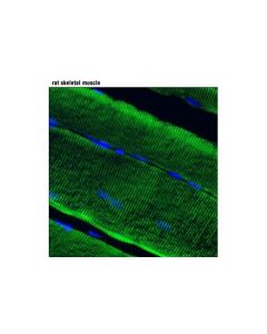 Cell Signaling Ryr1 (D4e1) Rabbit mAb