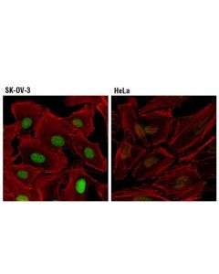Cell Signaling Sox17 (D1t8m) Rabbit mAb
