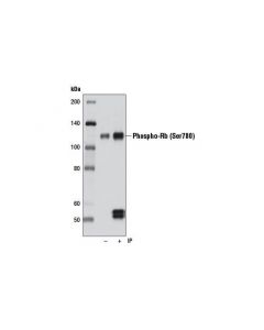 Cell Signaling Phospho-Rb (Ser780) (D59b7) Rabbit mAb