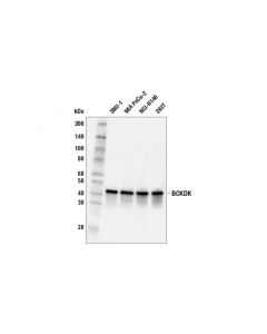 Cell Signaling Bckdk (E5b6j) Rabbit mAb
