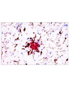Cell Signaling Signalstain Ihc Dual Staining Kit (Hrp, Rabbit, Brown / Ap, Mouse, Red)