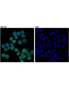 Cell Signaling Ephb2 (D2x2i) Rabbit mAb