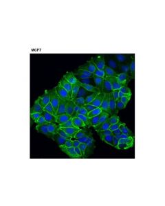 Cell Signaling Nkcc1 (D13a9) Rabbit mAb