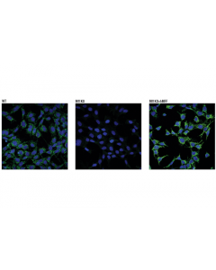 Cell Signaling Mff (E5w4m) Xp Rabbit mAb