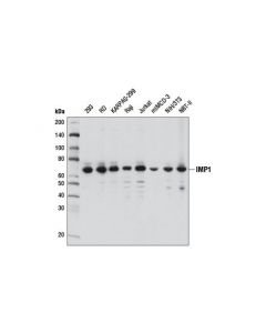 Cell Signaling Imp1 (D33a2) Rabbit mAb
