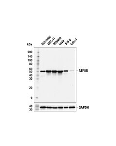 Cell Signaling ATP5B (E8A5A) Rabbit mAb