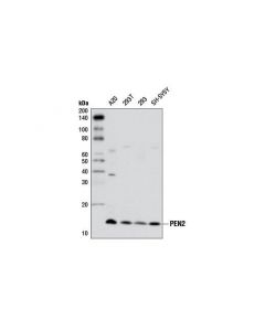 Cell Signaling Pen2 (D2g6) Rabbit mAb
