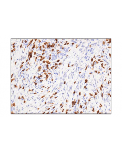 Cell Signaling Cd3epsilon (D7a6e) Xp Rabbit mAb