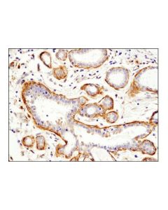Cell Signaling Palladin (D9h2) Rabbit mAb