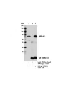 Cell Signaling Ubqln2 (D7r2z) Rabbit mAb