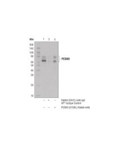 Cell Signaling Pcsk9 (D7u6l) Rabbit mAb