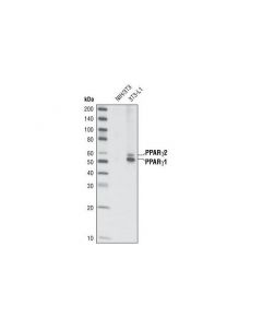Cell Signaling Nuclear Receptor Antibody Sampler Kit