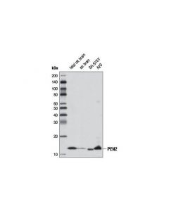 Cell Signaling Pen2 (D6g8) Rabbit mAb