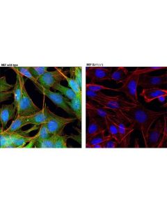 Cell Signaling Parkinsons Research Antibody Sampler Kit