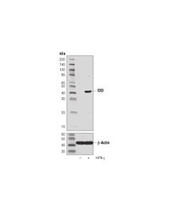 Cell Signaling IDO (D5J4E™) Rabbit mAb