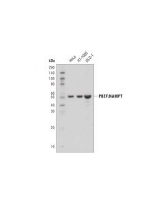 Cell Signaling Pbef/Nampt (D7v5j) Rabbit mAb