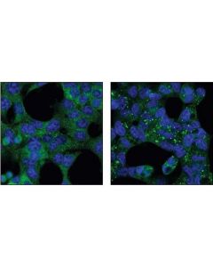 Cell Signaling Autophagosome Marker Antibody Sampler Kit
