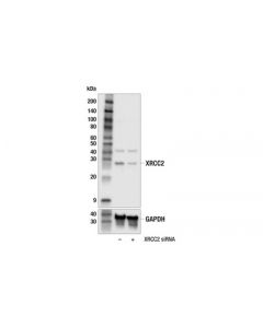 Cell Signaling Xrcc2 (E7m8y) Rabbit mAb