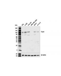 Cell Signaling Tox4 (E9u3l) Rabbit mAb