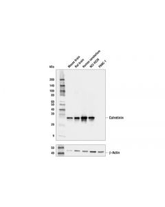 Cell Signaling Calretinin (E7r6o) Xp® Rabbit mAb (Bsa And Azide Free)