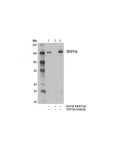 Cell Signaling Vcip135 Antibody