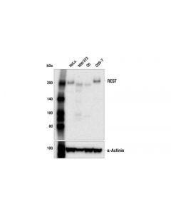 Cell Signaling Rest (E3l2i) Rabbit mAb