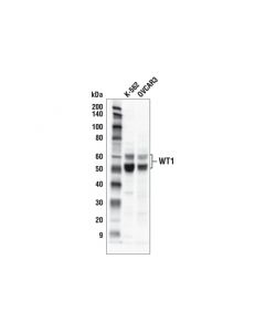 Cell Signaling Wt1 (D8i7f) Rabbit mAb (Bsa And Azide Free)