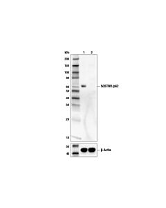 Cell Signaling SQSTM1/p62 (D5L7G) Mouse mAb