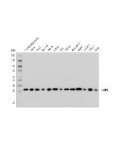 Cell Signaling Ucp2 (D1o5v) Rabbit mAb