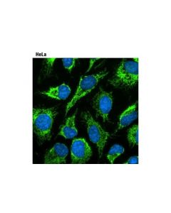 Cell Signaling Prolong<Lt/>Sup&Gt;® <Lt/>/Sup&Gt;Gold Antifade Reagent With Dapi