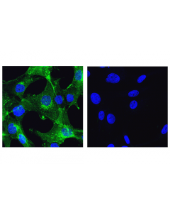 Cell Signaling Ncam-L1 (D5n9s) Rabbit mAb
