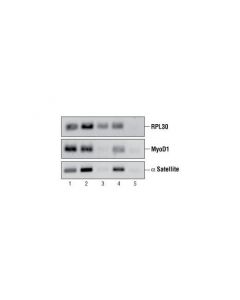 Cell Signaling Simplechip Enzymatic Chromatin Ip Kit (Agarose Beads)