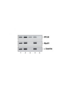 Cell Signaling Simplechip Enzymatic Chromatin Ip Kit (Magnetic Beads)