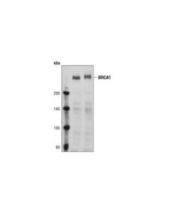 Cell Signaling Brca1 Antibody