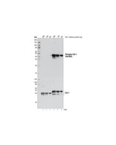 Cell Signaling Elk-1 Control Proteins