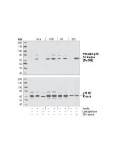 Cell Signaling Phospho-P70 S6 Kinase (Thr389) Antibody