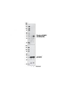 Cell Signaling P38 Mapk Control Cell Extracts