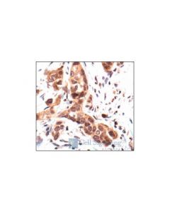 Cell Signaling P38alpha Mapk Antibody