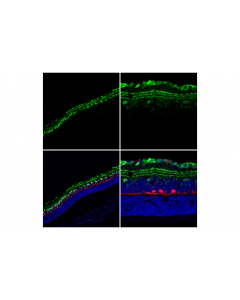 Cell Signaling Calretinin (E7r6o) Xp Rabbit mAb