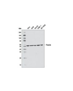 Cell Signaling Fascin (D1a8) Rabbit mAb