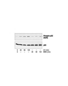 Cell Signaling Phospho-P53 (Ser6) Antibody