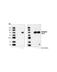 Cell Signaling Rb Control Proteins