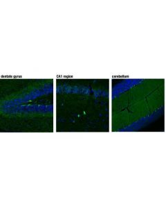 Cell Signaling Cannabinoid Receptor 1 Downstream Signaling Antibody Sampler Kit