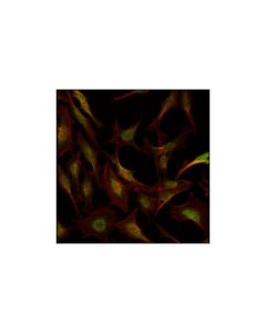 Cell Signaling Rsk1/Rsk2/Rsk3 (32d7) Rabbit mAb
