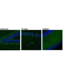 Cell Signaling Cb1 Receptor (D5n5c) Rabbit mAb