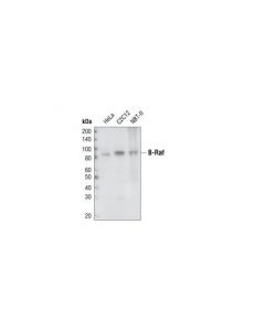 Cell Signaling B-Raf (55c6) Rabbit mAb