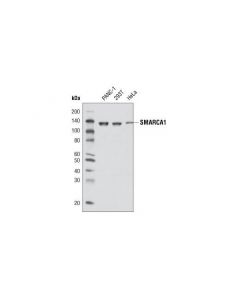 Cell Signaling Smarca1 Antibody