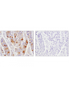 Cell Signaling Phosphoplus Glycogen Synthase (Ser641) Antibody Duet