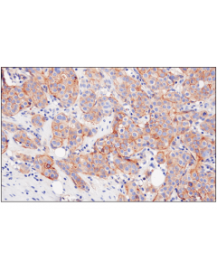 Cell Signaling Nectin-2/Cd112 (D8d3f) Xp Rabbit mAb