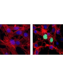 Cell Signaling Cleaved Parp (Asp214) Antibody (Mouse Specific)